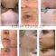 ce certificate ipl beauty machine for hair removal / e light ipl rf beauty equipment / ipl device