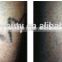Beauty Equipment Q SwitCh ND Yag Laser Tattoo Removal Machine For Women Skin Rejuvenation