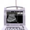 MCB-18A 12.1"LED Screen Full Digital Portable Ultrasound Scanner