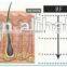 The Newest In Technology E-light IPL Thread Hair Removal RF Skin Rejuvenation Beauty Salon Equipment
