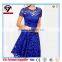 Hot Sell on Amazon High Quality Lace Casual Dresses