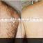 2016 Good Sales IPL SHR Elight System/ SHR Hair Removal Machine Price/SHR Beauty Machine