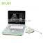 Manufacture Supplies Laptop Ultrasound Scan Machine- BPU09