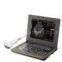 CMS600P Palm-size Medical Ultrasound scanner