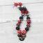 Lovely mouse Necklace,BubbleGum chunky bead necklace with headband,crystal mouse pendent