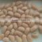 popular food of canned white kidney beans you wanted