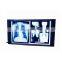 MA1149-N x ray accessaries 3 photosensors duplex LED medical x-ray film viewer