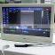 HC-A005 New Portable Digital B Ultrasound for Pregnant Women/hospitals,etc.
