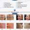 Skin Rejuvenation / Wrinkle Remover Portable rf Fractional Micro Needle Machine