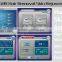 2016 portable SHR IPL Elight BS-SHR2