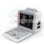 HC-A002  super popular hospital medical equipment ultrasound machine LED full digital ultrasound scanner