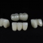 Dental laboratory dental restorations xztitanium alloy 3d printed partial framework dentures