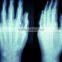 HOT selling thermal dry medical x-ray film /medical x-ray film agfa with CE hot film asia blue