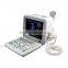 China Medical Ultrasonic Equipment pc based usb ultrasound scanner with cheap price