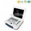 High resolution portable Ultrasonic Scanner System Full-digital Laptop Type Diagnostic Ultrasound Machine