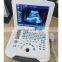 DW580 Full-digital Laptop Ultrasound Scanner
