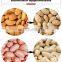 Automatic Almond Kernel Removing Machine Peanut Peeler Walnut Cracking Machine