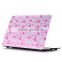 new ideas 2016 laptop case plastic protective sleeve for Macbook