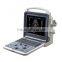 portable vascular doppler K6