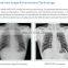 MY-D047B medical apparatus hospital radiology equipment UC arm x-ray unit digital radiography system