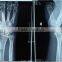 x ray fillm /medical dry film / x ray machine film price