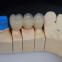 Full Porcelain Crowns America Outsourcing Dental Lab
