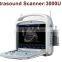 Best China Supply Digital Portable Ultrasound Scanner