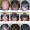 World best selling products hair rejuvenation laser machine for hair growth