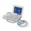 MABS02 Medical Cheap Portable Bladder Scanner