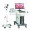 CE certificate High quality Digital Optical Video Vagina Colposcope  For Gynecology