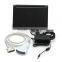 2016 high quality digital Laptop vet Ultrasound Scanner convex linear portable VET Ultrasound machine for sale
