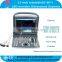 LED rotatable Ultrasound Scanner with 2.5-5.0MHz Convex probe USB VGA Video LAN port CE ISO approved