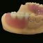 Removable Dentures and Partials Lab