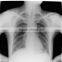 Konida Xray medical dry film compatible with Agfa Drystar and Fuji Drypix