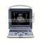 2016 beautiful 3d/4d ultrasound color doppler scanner with fetus