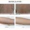 GSD Advanced Ipl Machine For Hair Removal/Skin Rejuvenation/e Light Ipl Rf Beauty Equipment