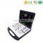 MY-A024A Medical 3D Color Doppler Ultrasound Machine Portable PC Ultrasound Scanner for SALE