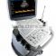 MC-DU-S11 Good Price Trolley 3D 4D General Color Doppler Ultrasound