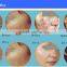 beijing factory provide CE approved portable Radio frequency fractional wrinkle removal machine for age spot and stains removing