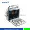Popular Portable Color Doppler Ultrasound Scanner Medical Equipment
