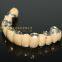 Dental crown composite, dental teeth, dental prosthesis, laboratoire dentaire, Dentallabor, laboratorio dental, dental laboratory, Shenzhen LJ dental lab China