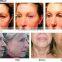 AYJ-T28 Dot matrix RF Wrinkle Removal Machine