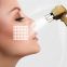 Fractional Laser 1550nm fiber laser acne scar treatment skin resurfacing non-ablative laser equipment pigment removal