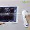 200mm Scanning depth wireless ultrasound probe -WBU01