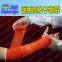 Light weight  Fiberglass Casting tape for bone fixation