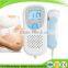 CE approved mini Fetal Doppler fetal Heart Baby Sound Monitor 3MHz Probe