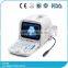 Lowe Price Medical Equipment Portable Cheap Ultrasound Scanner/Machine 3.5Mhz Multi-frequency Convex Probe