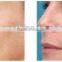 10MHz Hot Selling E-light IPL RF Multifunction 2.6MHZ Machine/ Laser IPL RF SKin Rejuvenation Machine