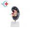HC-S266 Advanced Kidney Anatomical Model/Renal Anatomical Model/Human Organ model