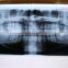 KENID xray film used on medical thermal printers high quality